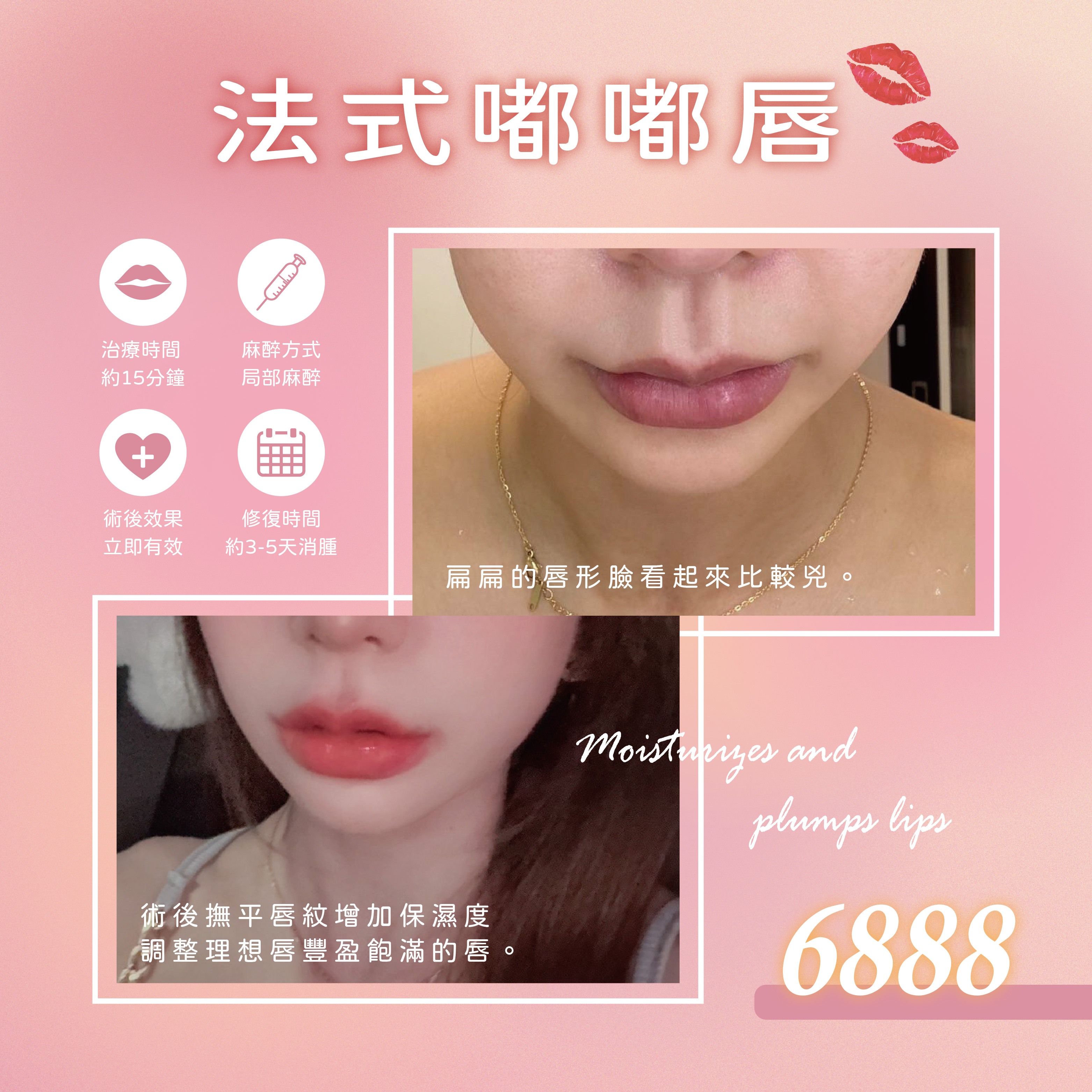 法式嘟嘟唇
